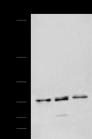 Anti-AGBL3 Rabbit Polyclonal Antibody