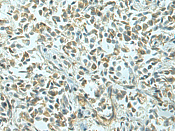 Anti-EPSTI1 Rabbit Polyclonal Antibody