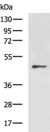 Anti-EPSTI1 Rabbit Polyclonal Antibody