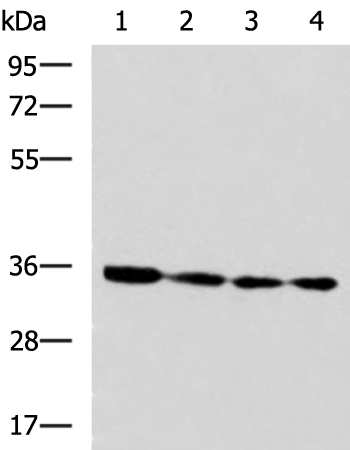 Anti-NUDT22 Rabbit Polyclonal Antibody