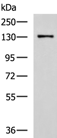 Anti-CASR Rabbit Polyclonal Antibody