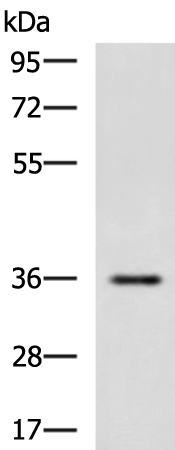 Anti-IBSP Rabbit Polyclonal Antibody
