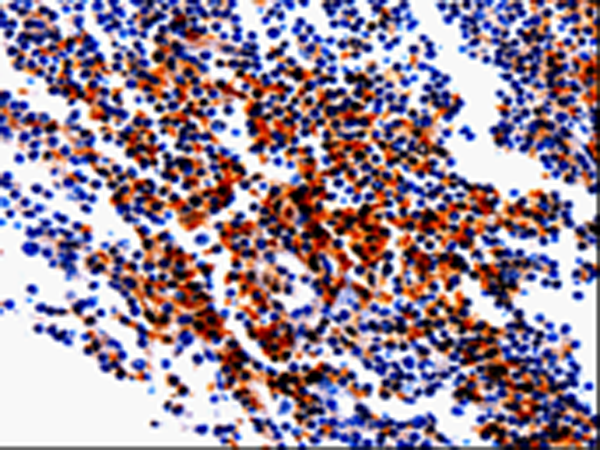 Anti-GDI1 Rabbit Polyclonal Antibody