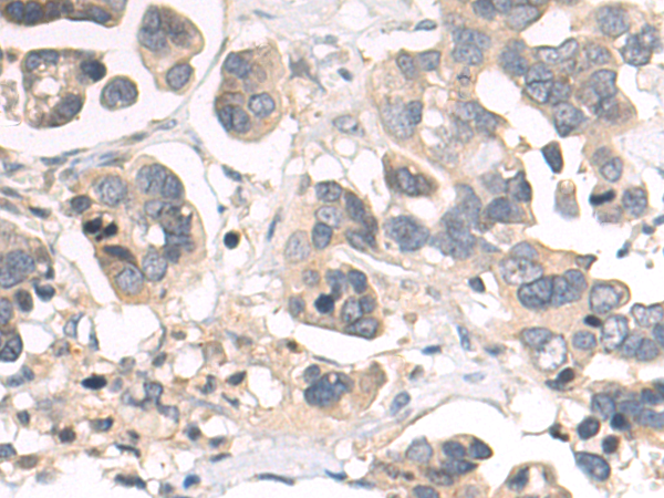 Anti-Epoxide Hydrolase 1 Rabbit Polyclonal Antibody
