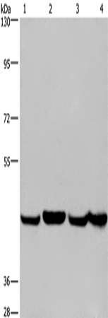 Anti-RBMY1A1 Rabbit Polyclonal Antibody