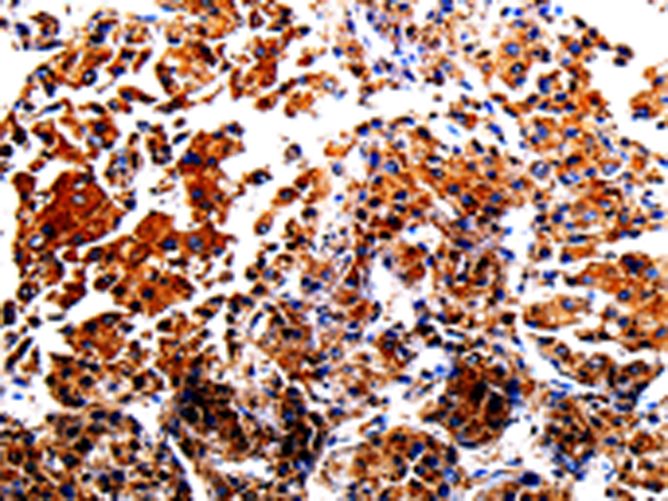 Anti-alpha 1 Fetoprotein Rabbit Polyclonal Antibody