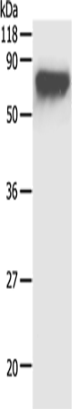 Anti-alpha 1 Fetoprotein Rabbit Polyclonal Antibody