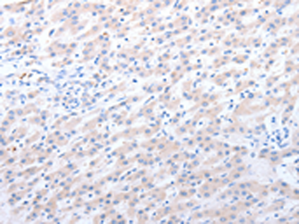 Anti-ALDH1A1/ALDH1A2/ALDH1A3 Rabbit Polyclonal Antibody