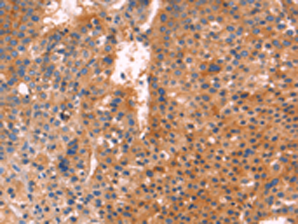 Anti-Anthrax Toxin Receptor 1 Rabbit Polyclonal Antibody