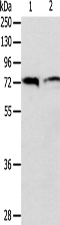 Anti-Anthrax Toxin Receptor 1 Rabbit Polyclonal Antibody