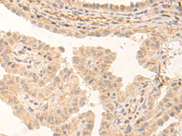 Anti-STAT4 Rabbit Polyclonal Antibody