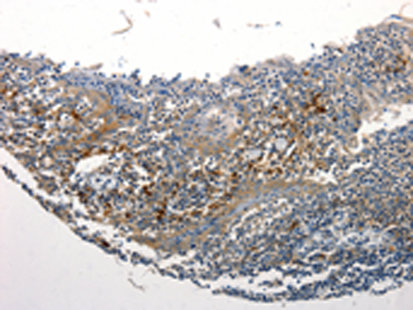 Anti-STAT5b Rabbit Polyclonal Antibody