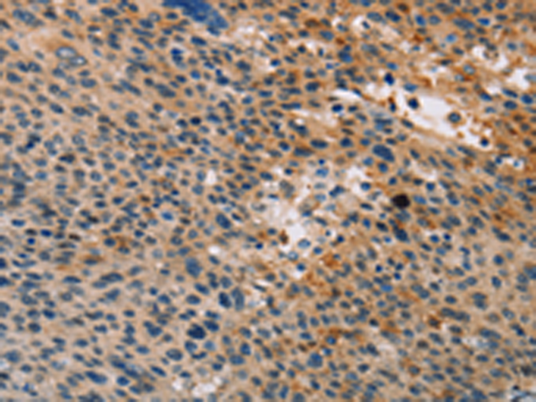 Anti-Toll-Like Receptor 1 Rabbit Polyclonal Antibody