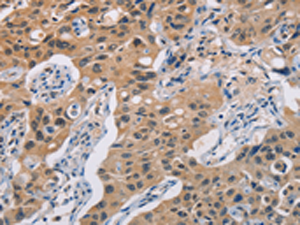 Anti-Toll-Like Receptor 3 Rabbit Polyclonal Antibody