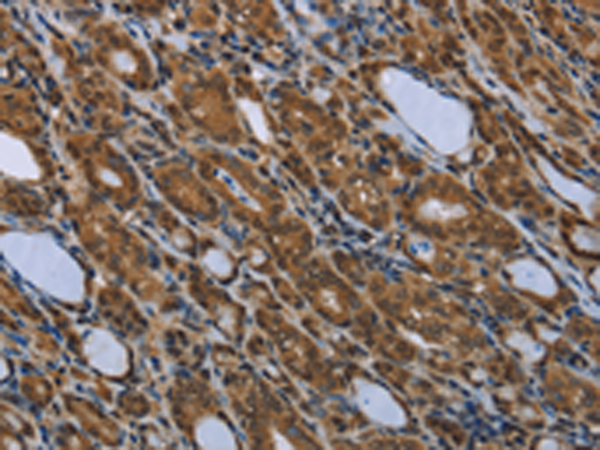 Anti-Smad4 Rabbit Polyclonal Antibody