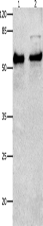Anti-Smad4 Rabbit Polyclonal Antibody