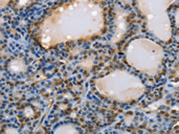 Anti-NFKBID Rabbit Polyclonal Antibody