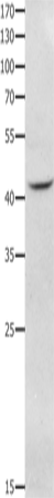 Anti-NFKBID Rabbit Polyclonal Antibody
