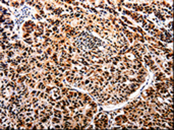 Anti-APIP Rabbit Polyclonal Antibody