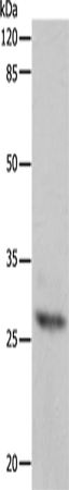 Anti-APIP Rabbit Polyclonal Antibody
