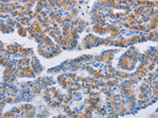 Anti-Bcl2 A1 Rabbit Polyclonal Antibody