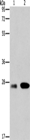 Anti-Bcl2 A1 Rabbit Polyclonal Antibody