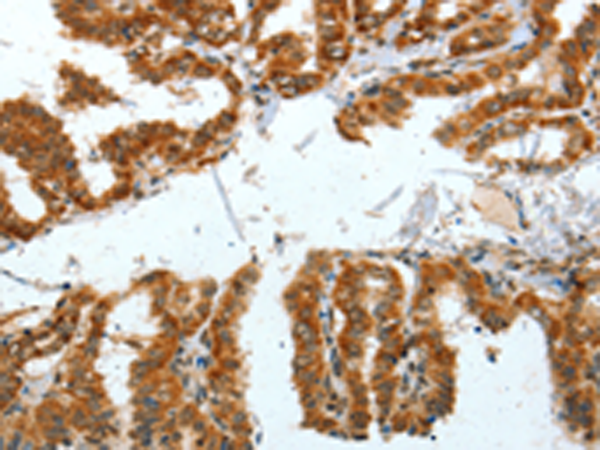 Anti-BNIP1 Rabbit Polyclonal Antibody