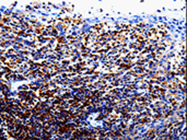 Anti-IL-10 Receptor alpha Rabbit Polyclonal Antibody