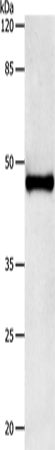 Anti-IL-11 Receptor alpha Rabbit Polyclonal Antibody