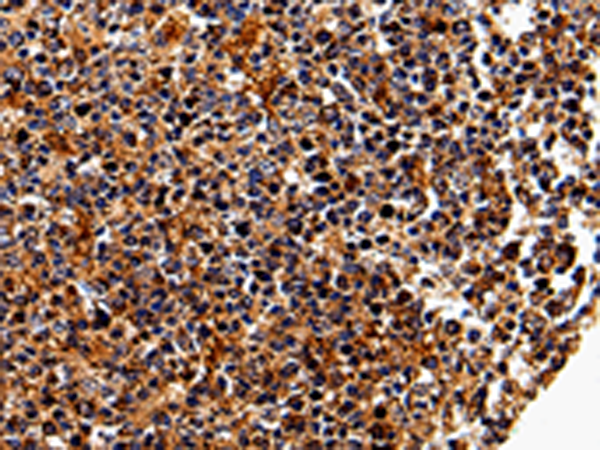 Anti-IL-17 Receptor C Rabbit Polyclonal Antibody
