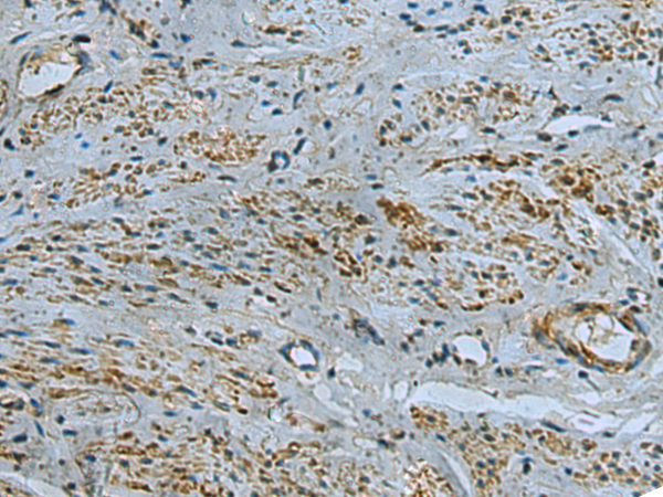 Anti-IL-17 Receptor D Rabbit Polyclonal Antibody