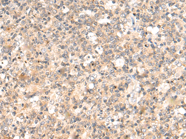 Anti-IL-18 Receptor 1 Rabbit Polyclonal Antibody