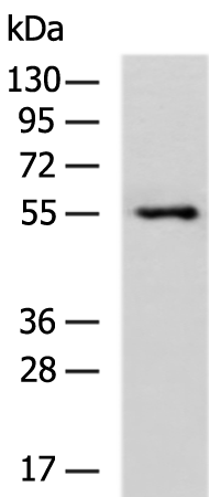 Anti-IL-18 Receptor 1 Rabbit Polyclonal Antibody