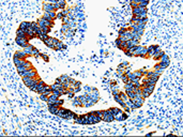 Anti-IL-23 Receptor Rabbit Polyclonal Antibody