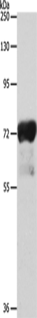 Anti-IL-23 Receptor Rabbit Polyclonal Antibody