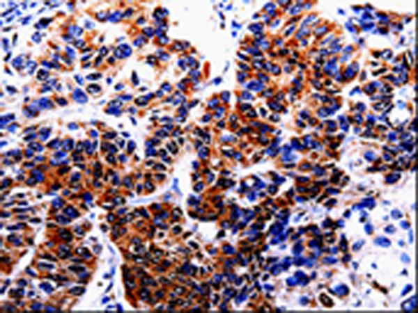 Anti-HTR2B Rabbit Polyclonal Antibody