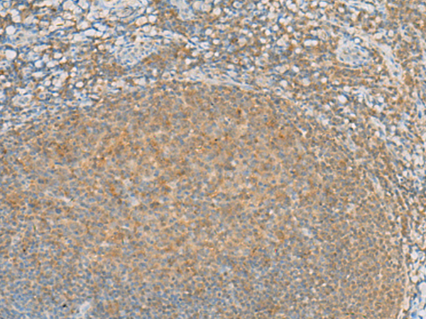 Anti-HTR3A Rabbit Polyclonal Antibody