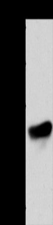 Anti-Adiponectin Receptor 1 Rabbit Polyclonal Antibody