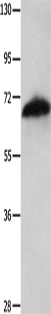 Anti-AIF Rabbit Polyclonal Antibody