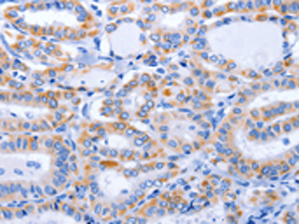 Anti-GFER Rabbit Polyclonal Antibody