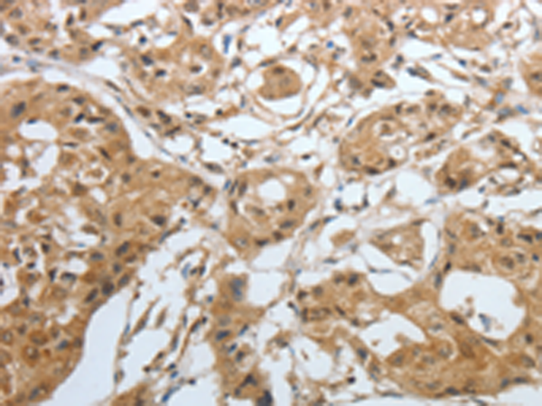 Anti-AMPH Rabbit Polyclonal Antibody
