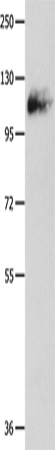 Anti-AMPH Rabbit Polyclonal Antibody