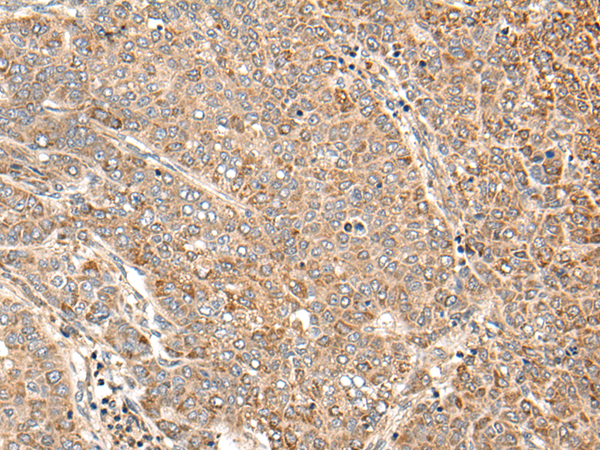 Anti-ANGPTL3 Rabbit Polyclonal Antibody