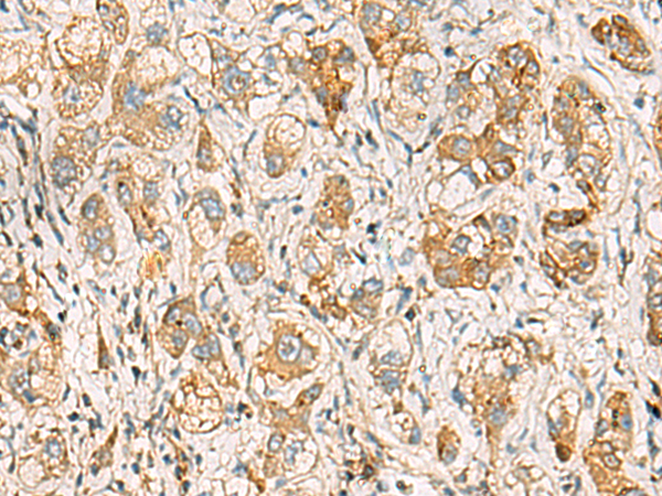 Anti-Annexin A13 Rabbit Polyclonal Antibody
