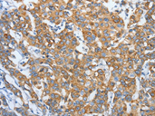 Anti-Keratin 81 Rabbit Polyclonal Antibody