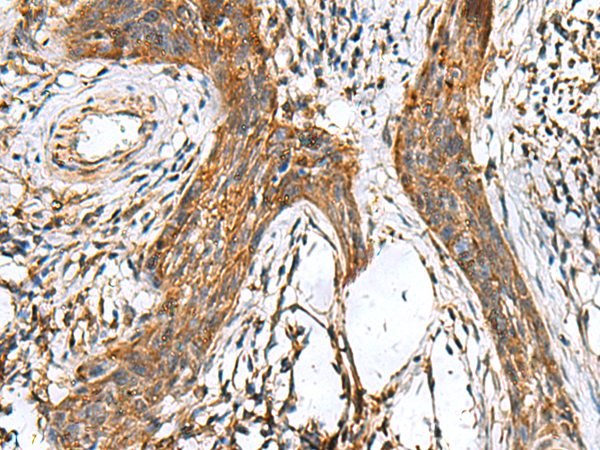 Anti-Prealbumin Rabbit Polyclonal Antibody