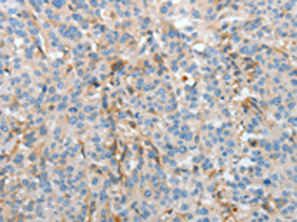 Anti-ApoH Rabbit Polyclonal Antibody