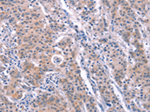Anti-ARC Rabbit Polyclonal Antibody