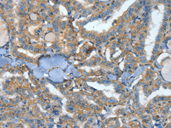 Anti-ATP4B Rabbit Polyclonal Antibody
