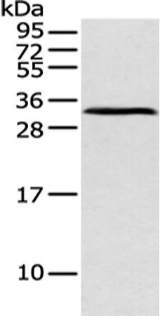 Anti-ATP4B Rabbit Polyclonal Antibody